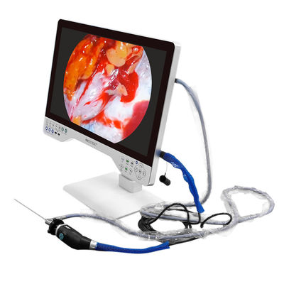 Buy Electric 4K Monitor Medical Endoscopy Camera with Built-in Light Source and USB Recording online manufacture