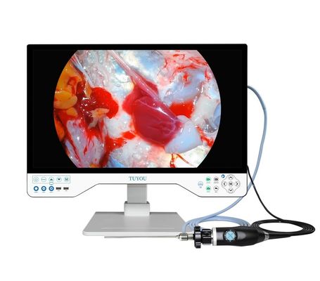 Buy All In One ENT Camera System With Portable HD Endoscope Camera And Light Source online manufacture
