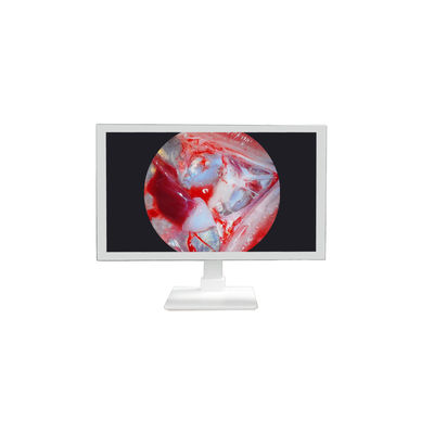 Buy FHD Medical Equipment 22 24 27 Inch Endoscope Camera Monitor Display Full HD Medical Monitor online manufacture