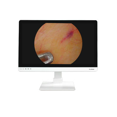 Buy 4K FHD Medical Equipment 27 Inch Endoscope Camera Monitor Display For Endoscope online manufacture