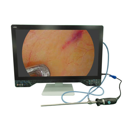 acheter TUYOU 32