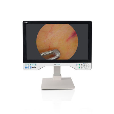 Buy 24 Inch Laparoscopic Monitor 4K UHD Endoscope Camera System Surgical LED With Light Source online manufacture