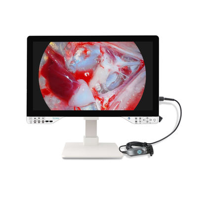 Buy Innovative Full HD Surgical Endoscope Camera Kit With Light Source And 27'' Monitor For Gynecology online manufacture