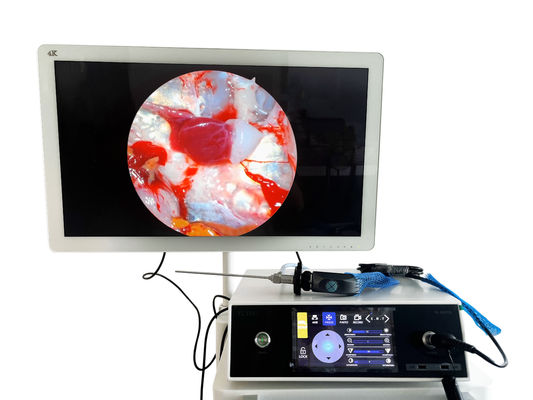Buy Full HD 1080P ENT Portable Endoscopy Camera With Touchscreen And LED Light Source online manufacture