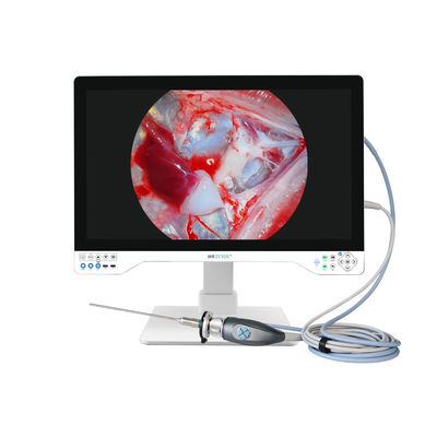 kaufen TUYOU 4K Starrendoskopie-Kamerasystem für Zystenfenestration Leber und HNO-Chirurgie on-line-Fertigung