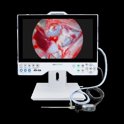 comprare 1080P Full HD Endoscope Camera System per la laparoscopia medica fabbricazione online
