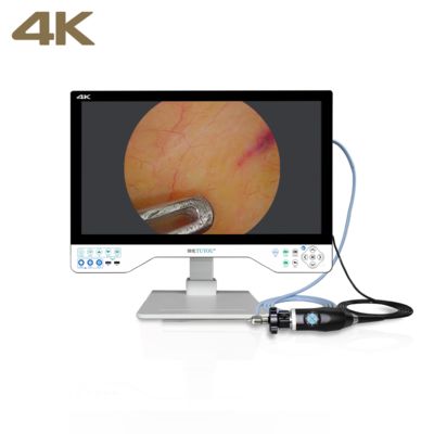 acheter Système de caméra d'endoscopie FHD tout-en-un TUYOU avec moniteur chirurgical de 24 pouces pour les procédures d'urologie fabrication en ligne