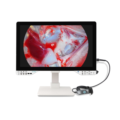 Buy 27inch FHD/4K All-in-one Endoscope Camera System for Nasal Ear Urology and Laparoscopic Surgery online manufacture