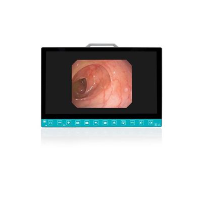 Buy TUYOU 13.3-Inch FHD Flexible Endoscope Camera System Multi-Color OEM Custom All-in-One Portable Uro-Gyn TikTok Hit online manufacture