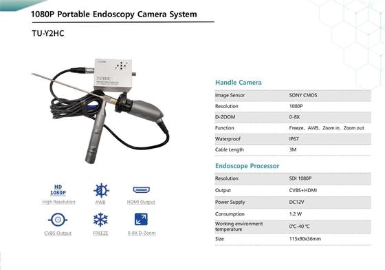 購入 TUYOU TU-Y2HC FHD ポータブル医療用内視鏡カメラ、HDMI/CVBS FOR ENT、0-8倍D-ズーム オンライン製造