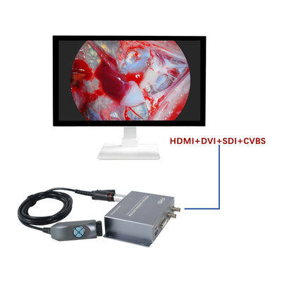 Купить TUYOU Manufacturer4-Output FHD портативная система камер эндоскопии для ЛОР-проверки онлайн изготовление