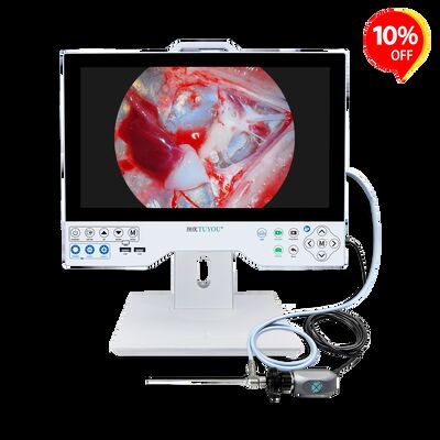 Buy Economical Full HD All-in-One Endoscope Camera System - CE Certified Integrated Monitor for Laparoscopy/Gynecology Exams online manufacture