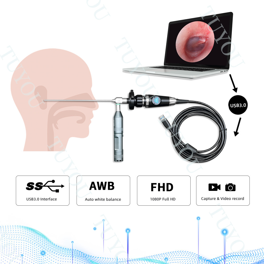 Manufacture Portable USB3.0 Endoscope Handle Camera For Medical ENT ...