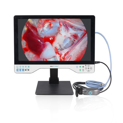 Laparoscopy Cystoscope Surgeries 24