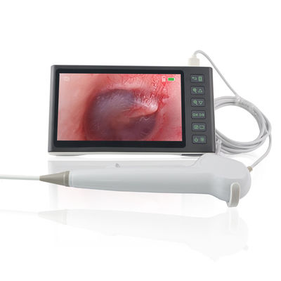 ENT Surgery White FHD Flexible Digital Visual Ear Picker Earwax Removal Tool Disposable Endoscope Camera 7 Inch IPS Screen