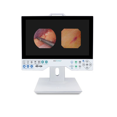 15.6/24/27/32 Inches TUYOU All In One Endoscope Camera For Laparoscopy Surgeries