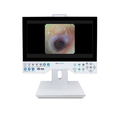 All in One Rigid and Flexible Endoscopy Camera TU-15LSD1E HDMI/SDI/CVBS/VGA/DVI Output Interface and Built-in Light Source