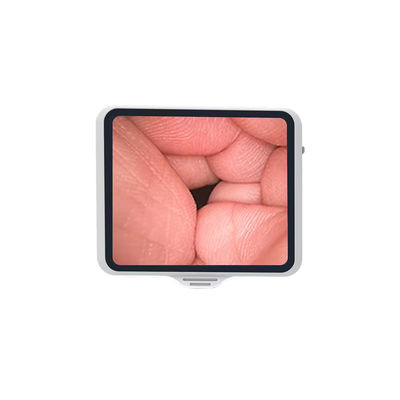TUYOU Flexible Endoscope With 3.5 Inch Screen, Reusable For Fiber Optic Bronchoscopy And Pet Health