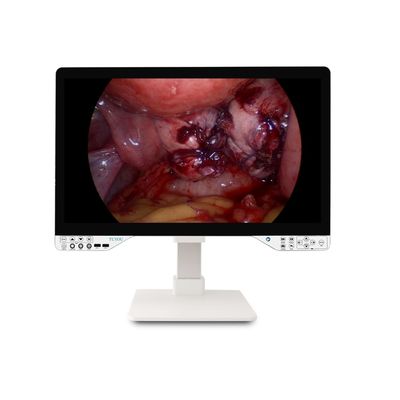 27 Inch FHD 1080P Endoscopic Camera System Only Rigid Endoscope with Monitor and 100W Effective Optical Power