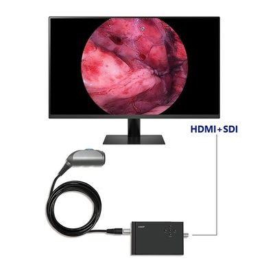TUYOU Portable Endoscopy Video Camera Full HD 1920x1080 Resolution 120 Degree Field of View for Urology Spine and ENT Surgery