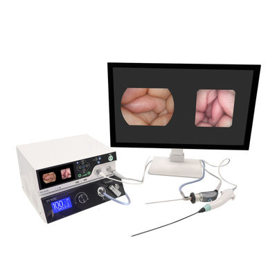 TUYOU Manufacturer 1080P Imaging Equipment With Rigid And Flexible Endoscopy Camera System For ENT