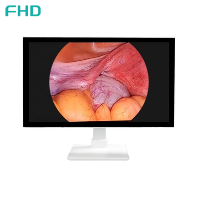 TUYOU All-in-One FHD Endoscopy Camera System with 32 Inches Surgical Monitor for ENT and Urology Procedures