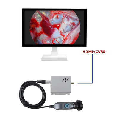Factory Wholesale 1080P Portable Endoscope Camera For Vet ENT Diagnose Use