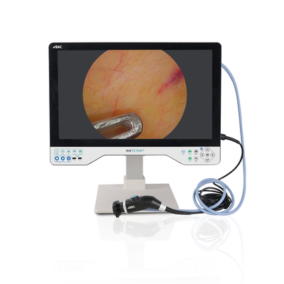 TU-24LSD1A  4K 24 Inch 4K Medical Endoscope Camera with 8h Battery IPX8