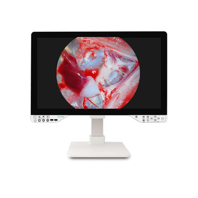 Medical Grade TUYOU 27 Inch All-in-One Endoscopic Camera - FHD/4K for ENT Laparoscopic Procedures