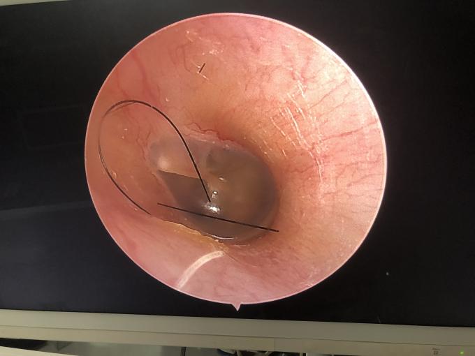 Portable LCD Monitor All In One HD Endoscopy Camera For ENT Laparoscopy Hysteroscopy Urology 2