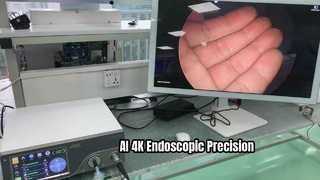 AI 4K Endoscopic Camera System for Surgery