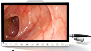 Portable 13.3 Inch 1080P Endoscopy Camera System With Recorder for Laparoscopy ENT Surgery